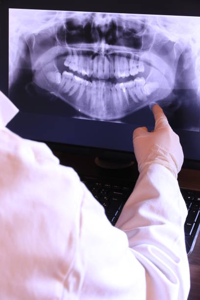 Best Emergency Root Canal Treatment in Palm Springs, CA
