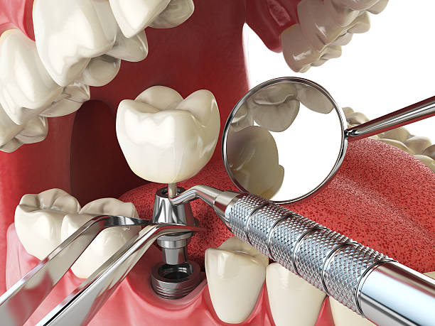 Best Emergency Dentist for Special Needs Patients in Palm Springs, CA